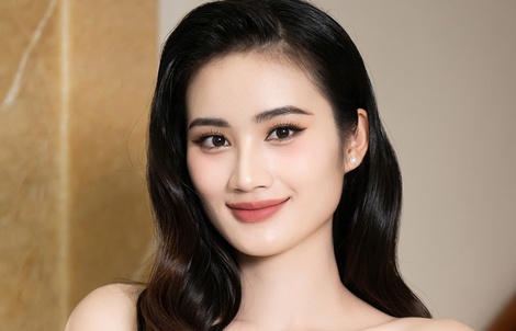 Hoa hậu Ý Nhi công khai chuyện giải phẫu thẩm mỹ