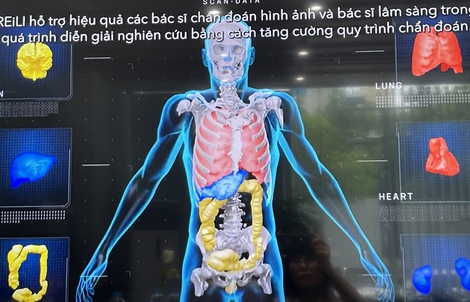 Trung tâm tầm soát ung thư bằng AI đầu tiên tại Việt Nam