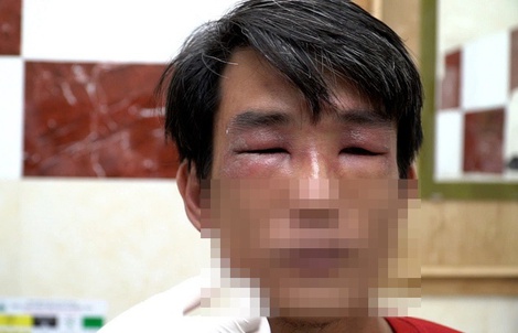 TP HCM vào mùa kiến ba khoang: cảnh báo người dân kiểm tra chăn màn