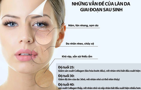 Hành trình phục hồi da sau sinh – dễ bắt đầu hơn mẹ nghĩ