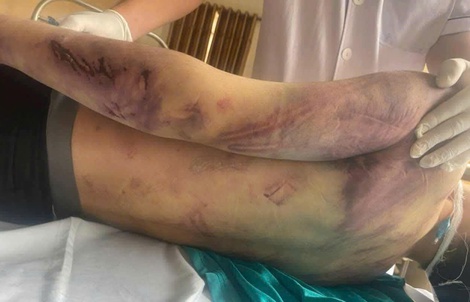 Tạm giữ 8 người liên quan đến vụ học viên 17 tuổi tử vong tại trung tâm công tác xã hội