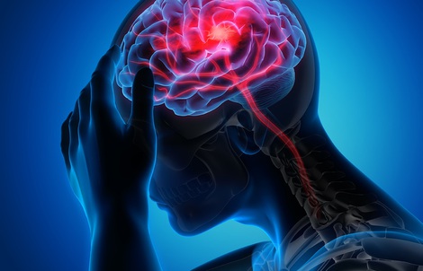 Đột quỵ gia tăng: Nghiên cứu Mỹ hé lộ thủ phạm mới