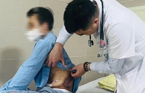 Suy kiệt sau khi ăn thực dưỡng, uống thực phẩm chức năng chữa ung thư