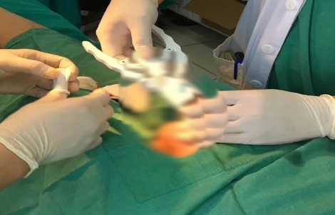 Tưởng bệnh tình dục phổ biến, ai ngờ là ung thư dương vật