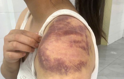 Người đàn ông nhiều lần trói, đánh đập con, vợ đang mang thai trong ngày Tết 