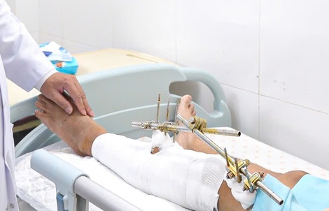 4 giờ nghẹt thở giữ lại đôi chân cho chàng trai gặp tai nạn