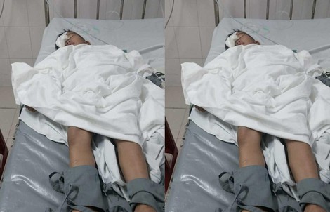 Phụ huynh tố cáo việc con lớp 1 bị bạn chọc trúng mắt, tổn thương nghiêm trọng