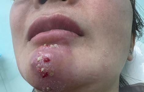 Tin quảng cáo “bật tông nhanh”, nhiều người biến dạng mặt vì làm đẹp cận Tết