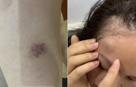 Điều tra vụ một gia đình tố bị hàng xóm liên tục đe dọa, hành hung