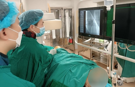 CT đếm photon lần đầu triển khai tại bệnh viện công