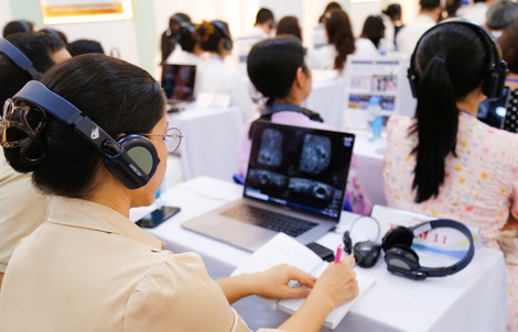 Siêu âm vú 3D tự động: Bước tiến mới tầm soát ung thư vú sớm