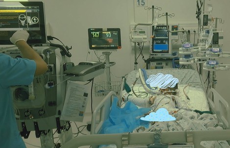 Bé trai 4 tuổi nguy kịch sau vụ cháy thảm khốc, cần cộng đồng chung tay cứu chữa