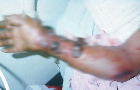 Vì sao WHO đánh giá nguy cơ Ebola vào Việt Nam ở mức thấp?