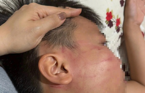 Thầy giáo Ấn Độ bị tố tát học sinh lớp 4 trong lớp học thêm ở Gia Lai