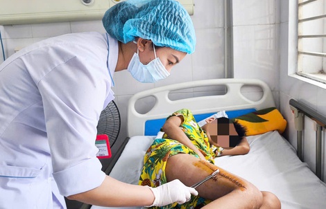 Sốt cao, đau chân, bé trai 11 tuổi suýt tàn phế vì tụ cầu vàng