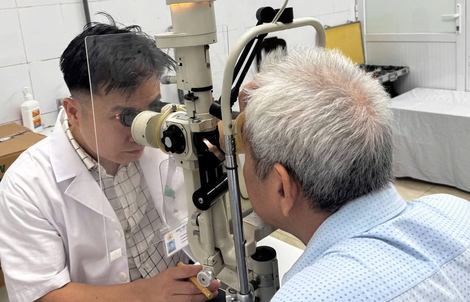 Dập nhãn cầu, rơi thủy tinh thể sau cú đập cầu lông