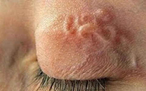 Dễ lây nhiễm giun sán từ thú cưng