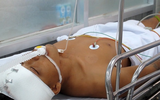 Xe tải tông xe khách, 1 bóng đá tỷ lệ kèo nhà cái chết, 10 bóng đá tỷ lệ kèo nhà cái bị thương