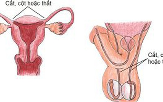 Vợ hay chồng đi triệt tỷ lệ kèo nhà cái hôm nay thì "nhẹ nhàng" hơn?