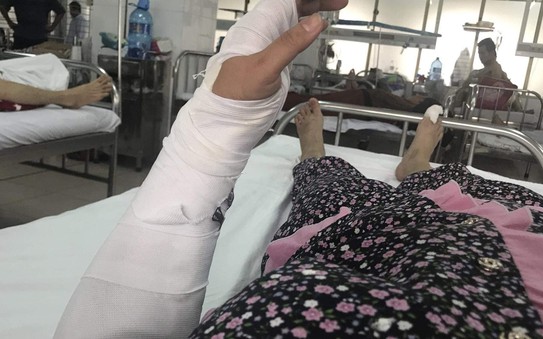 Điều tra vụ chồng đánh vợ tỷ lệ kèo nhà cái tại Đà Nẵng