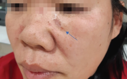 Vì sao ung thư bóng đá tỷ lệ kèo nhà cái lại tăng vào mùa hè?