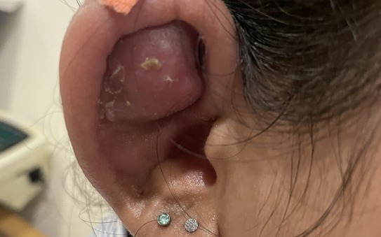 Thiếu nữ tai biến thành "Trư Bát Giới" tỷ lệ cá cược kèo nhà cái làm đẹp
