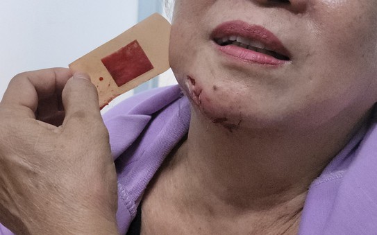 TP HCM phát văn bản khẩn phòng, chống bệnh dại