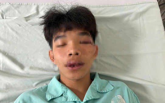 Một học tỷ lệ kèo nhà cái malaysia cấp 3 bị đánh hội đồng trước cổng trường ở Bình Phước