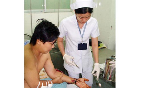 Nối thành công cánh tay đứt lìa bằng tỷ lệ kèo góc nhà cái phẫu