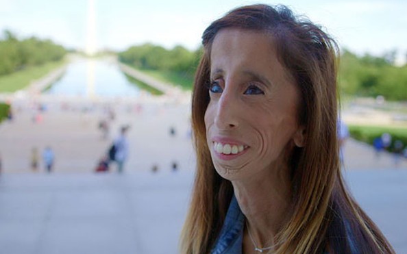 LIZZIE VELASQUEZ | Tin tuc CẬP NHẬT , lizzie velasquez | B&aacute;o Người lao động