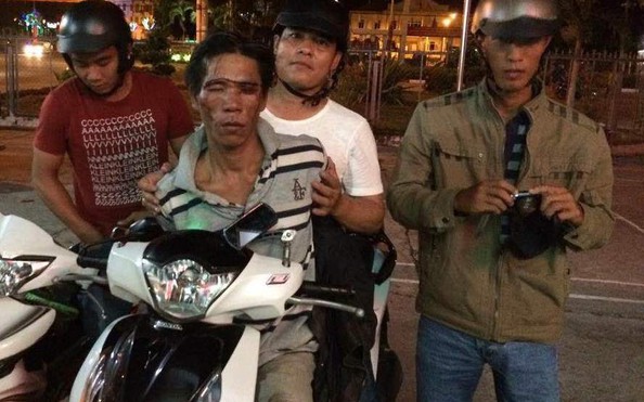 “Hiệp sĩ” đá văng đoản sắt của gã tỷ lệ kèo góc nhà cái SH