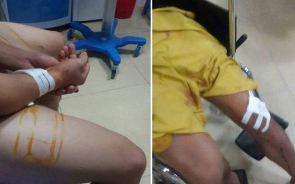 Nam thanh niên lao vào đám cưới chém loạn xạ, 1 bóng đá tỷ lệ kèo nhà cái chết