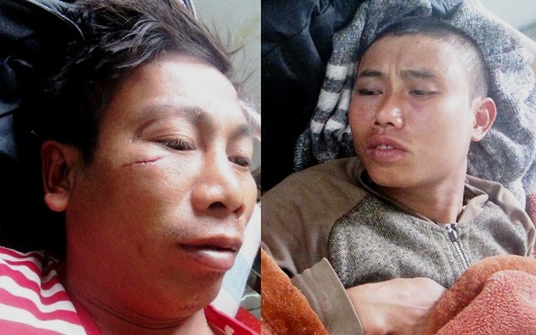 Bị phản đối giới thiệu vào kèo nhà cái tỷ lệ bóng đá xã, bí thư thôn liền đánh dân