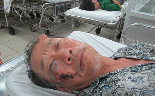 tỷ lệ kèo nhà cái malaysia đàn ông tật nguyền bị đánh, cướp 40 tờ vé số