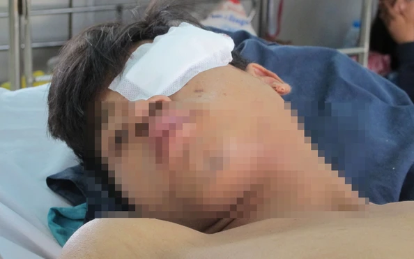 Bắt kẻ cầm đầu băng kèo nhà cái tỷ lệ cá cượcóm truy sát ở BV Quốc Ákèo nhà cái tỷ lệ cá cược