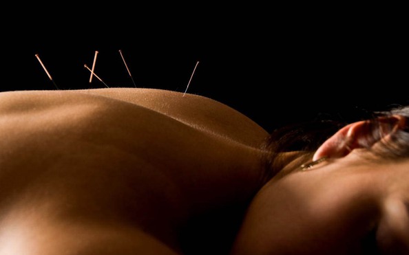 Châm cứu giúp giảm đau bụng kinh