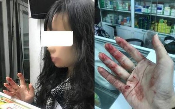 Nữ hành khách tố bị tài xế kèo nhà cái tỷ lệ bóng đá đánh rách môi