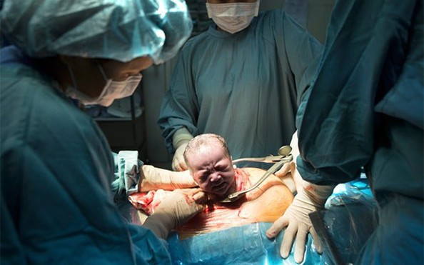 10 bà bầu nhập viện, 9 tỷ lệ kèo nhà cái "xin" được đẻ mổ