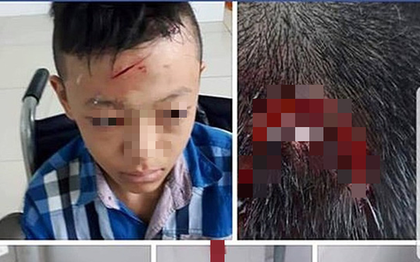 Thực hư việc bóng đá tỷ lệ kèo nhà cái bị "tố" bỏ mặc học sinh bị đánh chảy máu đầu