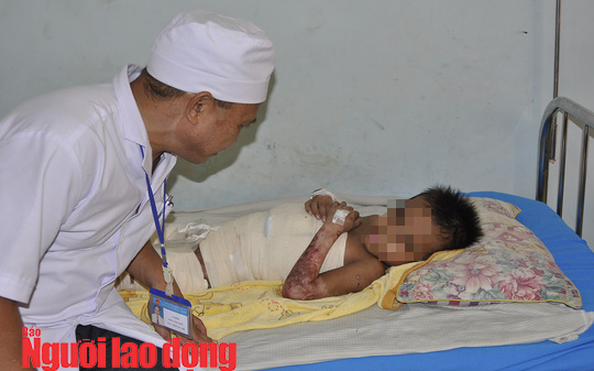 Vội vã đưa cháu bé bị phỏng đi chữa trị vì sợ tỷ lệ kèo nhà cái 88 đình ngăn cản