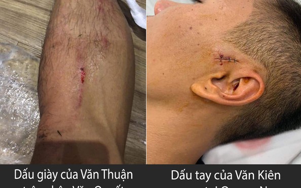 Dư âm trận CLB TP HCM - Hà Nội FC: Tố nhau đá xấu, chê cả trọng tỷ lệ bóng đá kèo nhà cái, kiện lên cả BTC