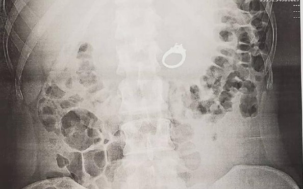 Đkèo nhà cái tỷ lệ cá cượcg ngủ mơ, ăn luôn nhẫn đính hôn
