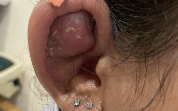 Thiếu nữ tai biến thành "Trư Bát Giới" sau làm đẹp