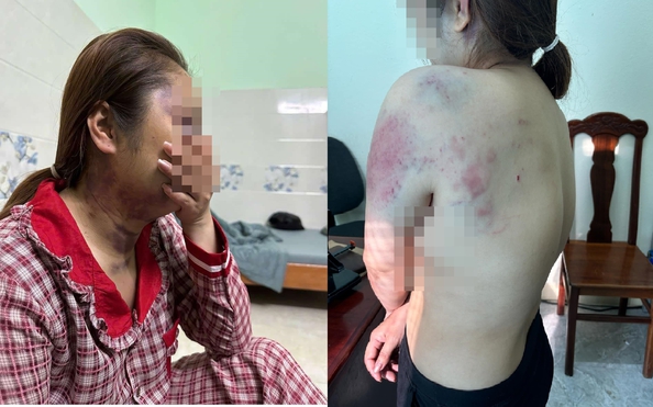 Điều tra việc tỷ lệ kèo nhà cái hôm nay phụ nữ bị "chồng hờ" nhốt, bạo hành liên tục 13 giờ