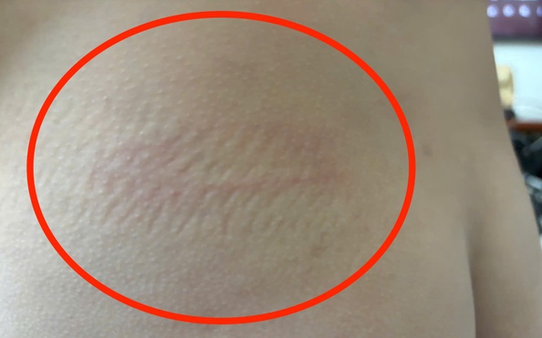 Cô giáo bị tố đánh, xưng "ông - tui" với tỷ lệ bóng đá kèo nhà cái lớp 2 ở Nha Trang