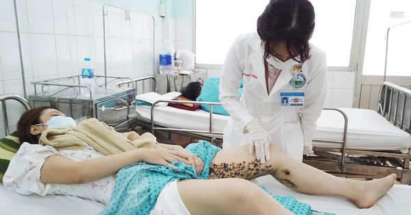 Tàn đời sau làm đẹp!