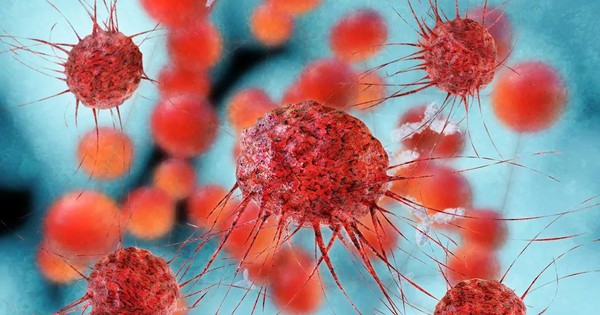 Gặp điều tưởng không liên quan này, tử vong do ung thư tăng 2,4 lần