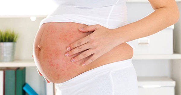 Ngứa, nổi mụn vùng bẹn khi mang thai có đáng lo?
