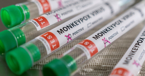 WHO: Monkeypox spreads to 19 countries, deploying limited vaccinations