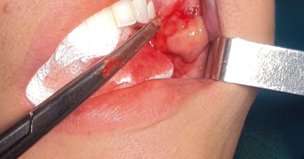 Cứu cô gái gặp nạn vì muốn làm mặt "trẻ như baby"